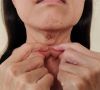 how-to-treat-neck-wrinkles